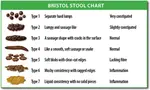 Bristol Stool Chart