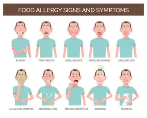 Food Allergy Symptoms & Treatment @ MDIMC