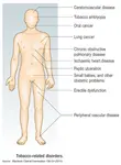 Smoking Disorders