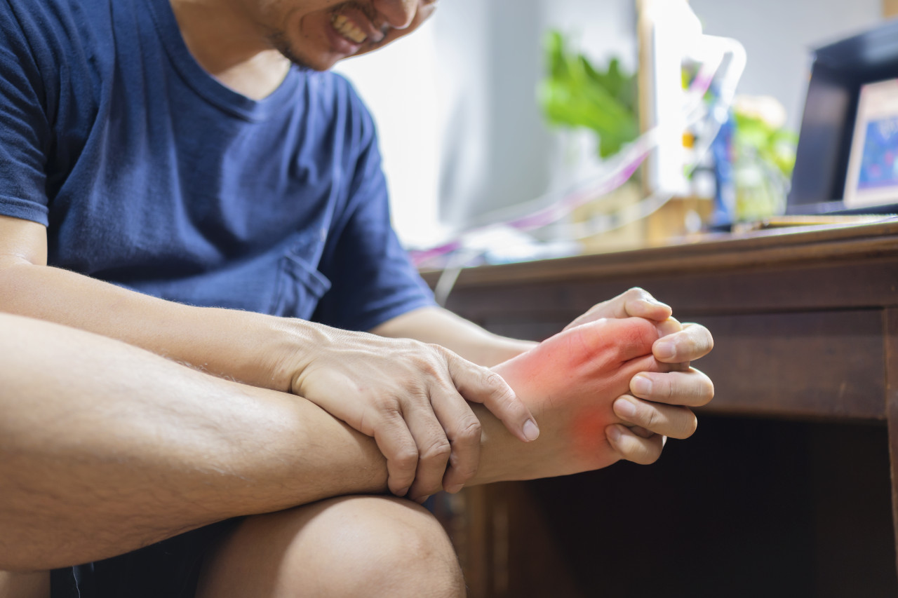 AMDA Clinic -Best GP doctor Healthcare treatment gout pain /inflamed foot toe non-surgical