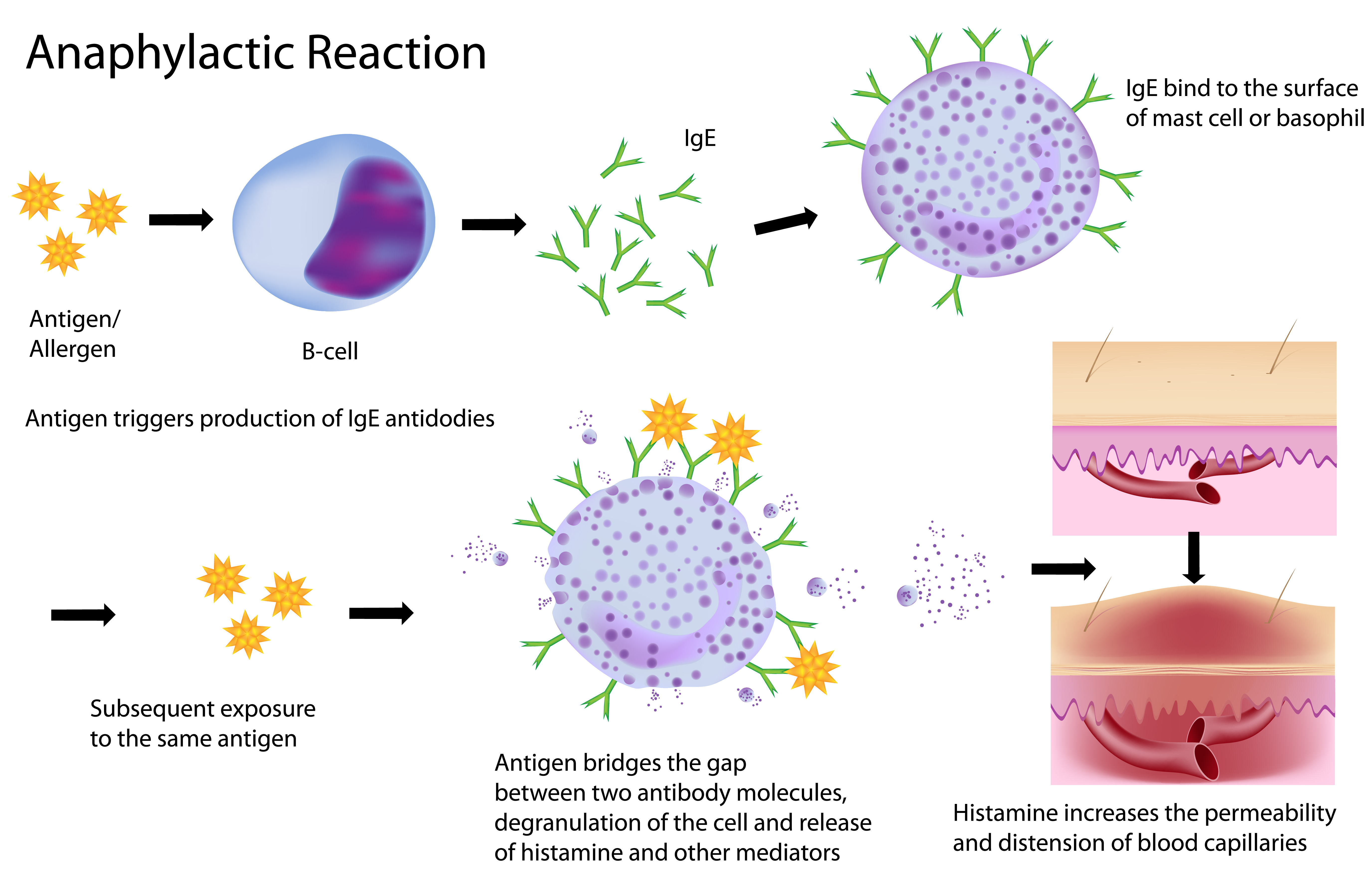 Anaphylactic Reaction & Allergy - Testing & Treatment @ MDIMC