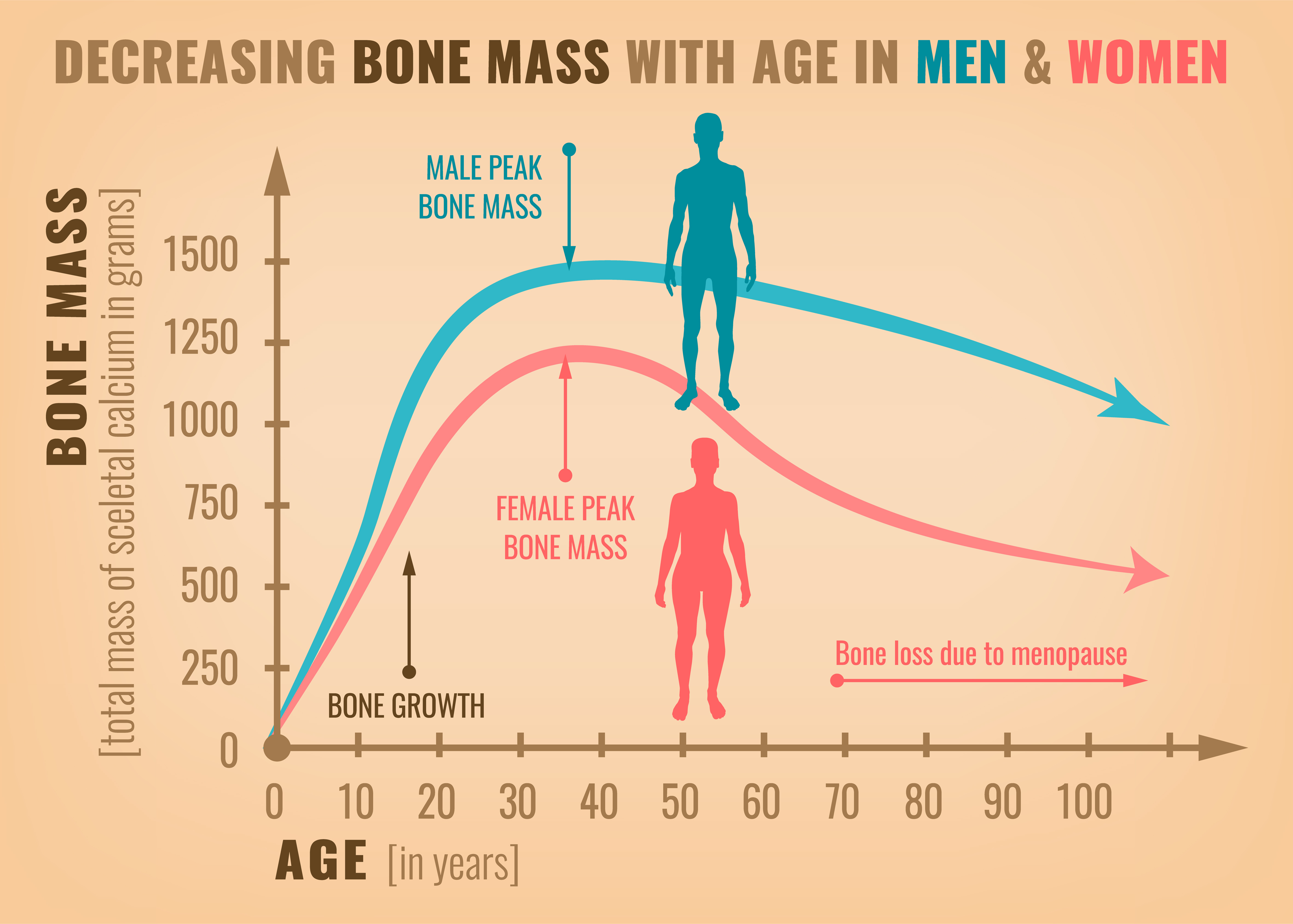 Bone Mass Loss for Men & Women with Age - Health Screening @ MDIMC