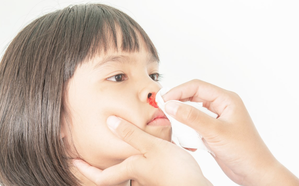 Child Nose Bleed / Epistaxis - Treatment AMDA SG Tel: 6694 1661