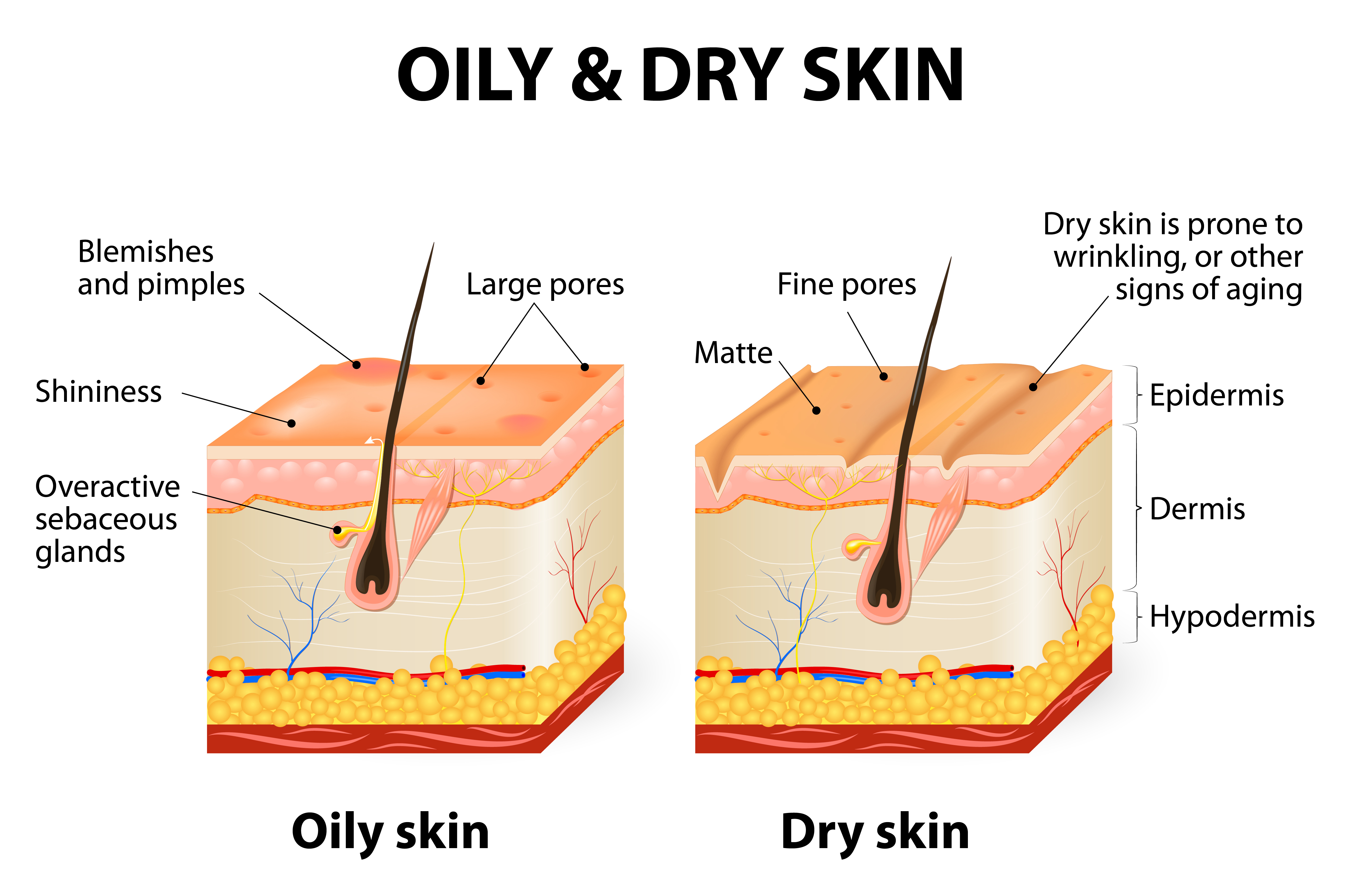 Dry or Oily Skin Treatment @ MDIMC