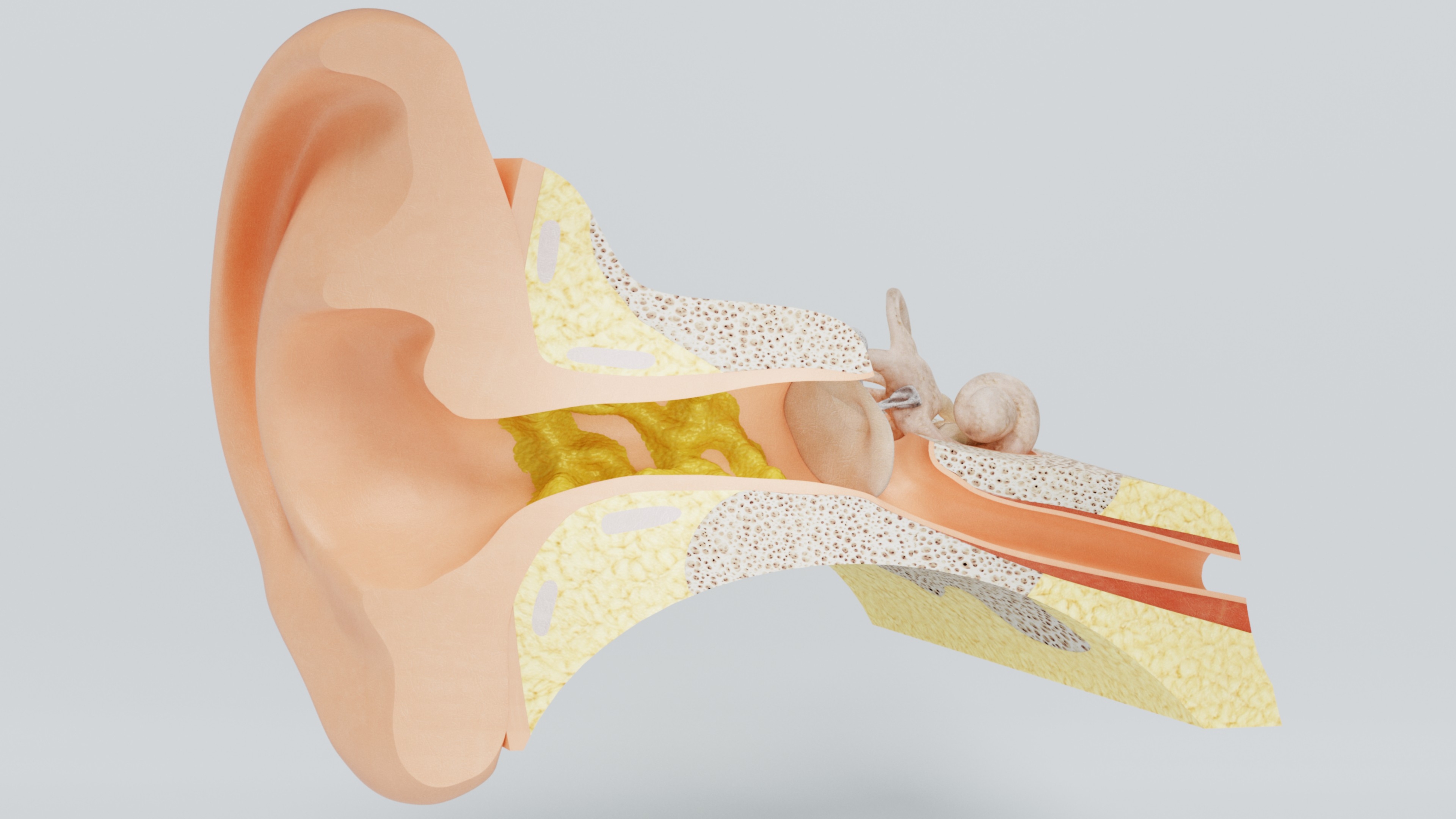 Ear wax Removal @ MDIMC