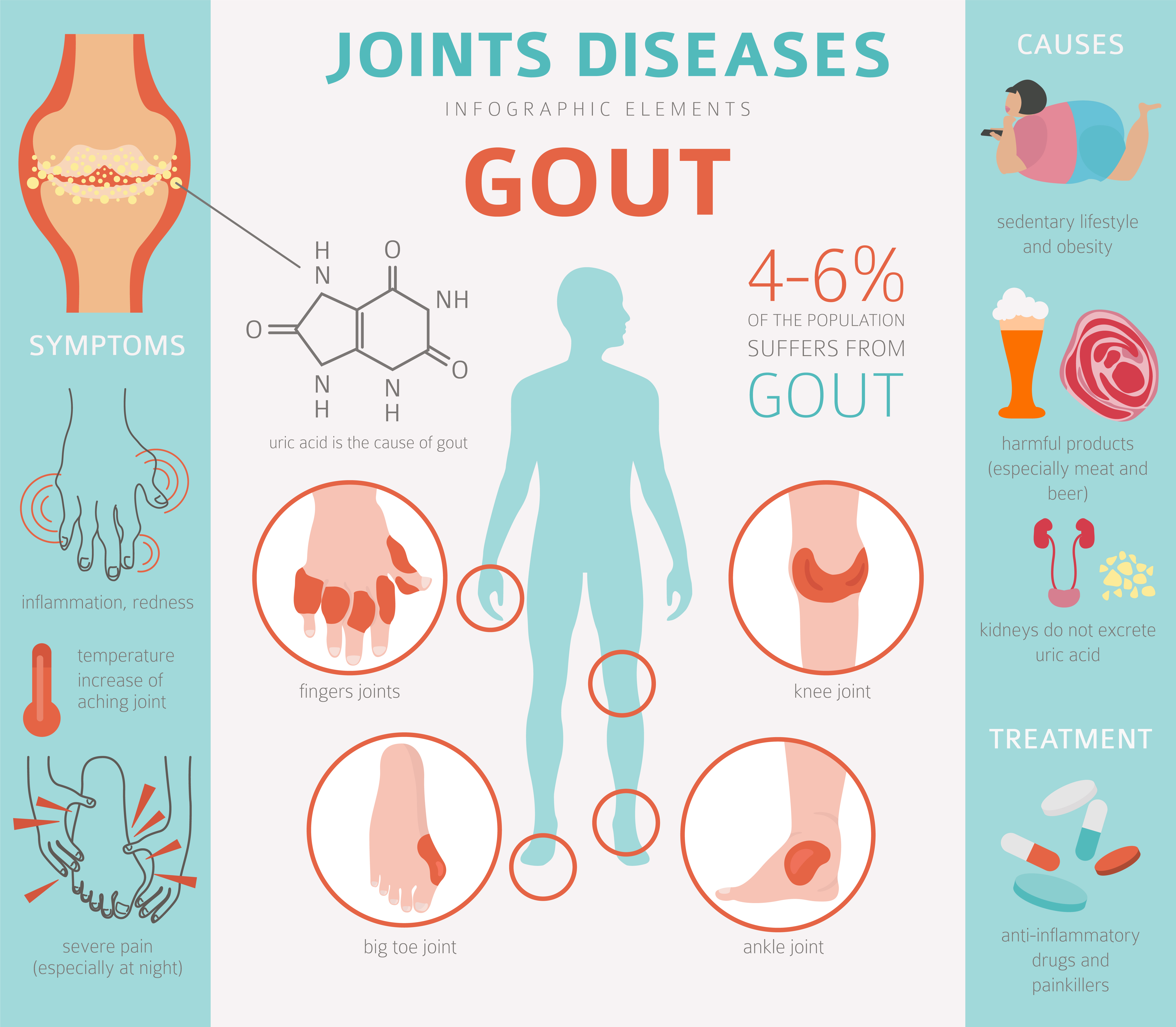 Gout Joint diseases Symptoms & Causes - Treatment @ MDIMC