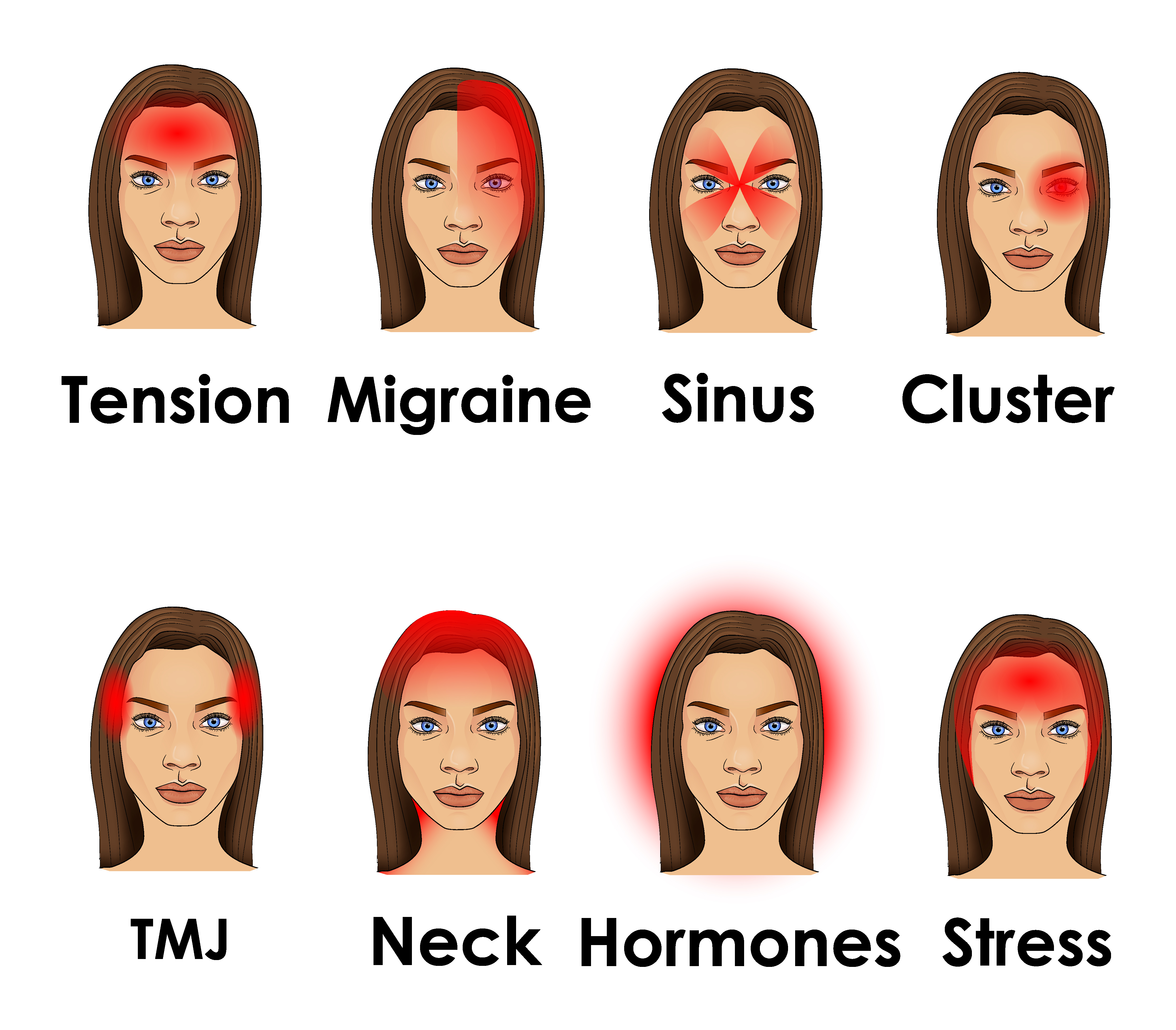 Headache Types / Migraine - Treatment @ MDIMC