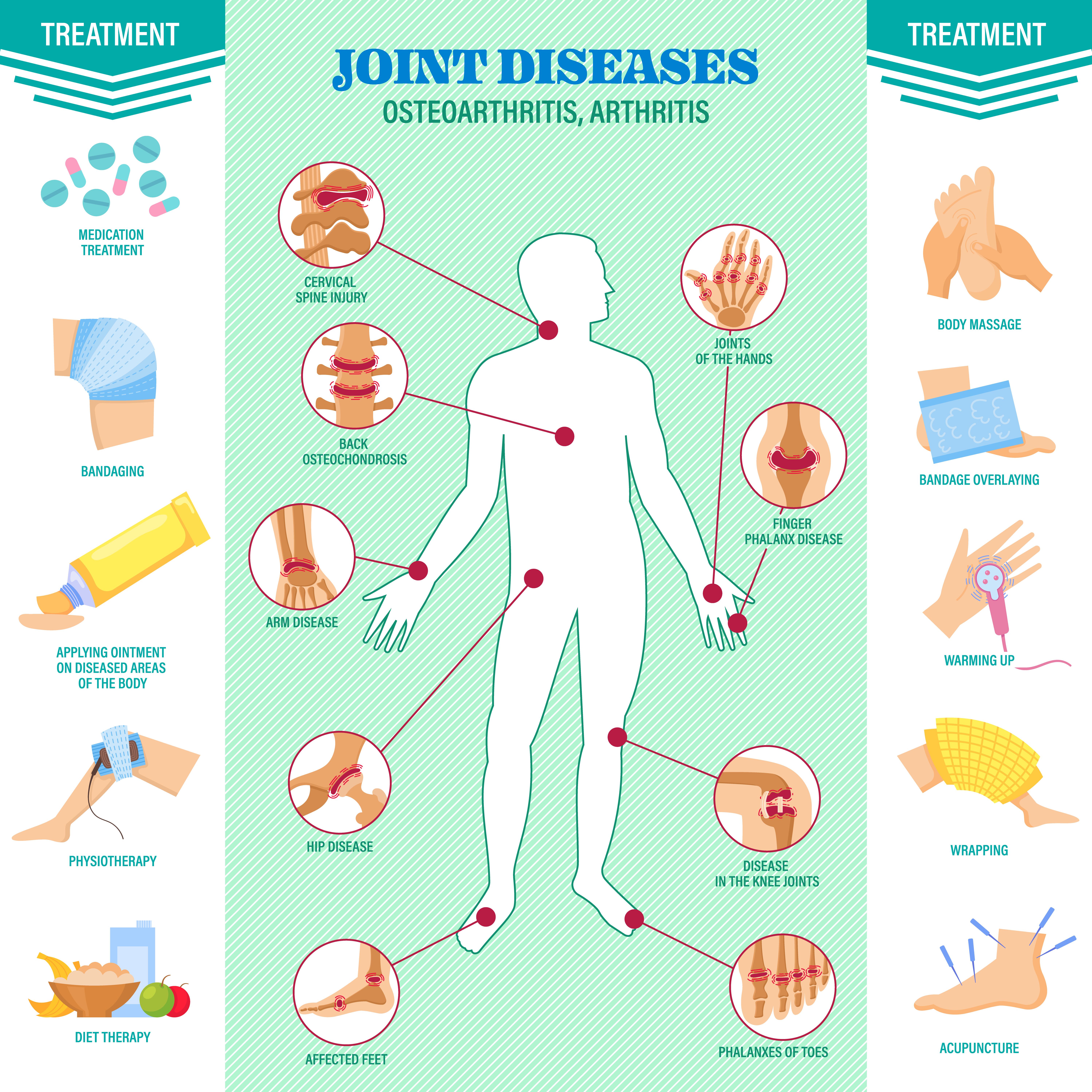 Joint Diseases Arthritis Osteoarthritis Treatment @ MDIMC