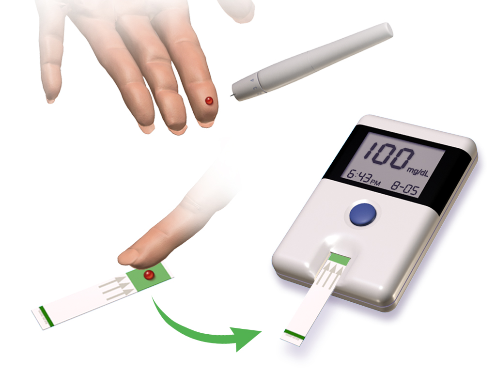 blood glucose level test