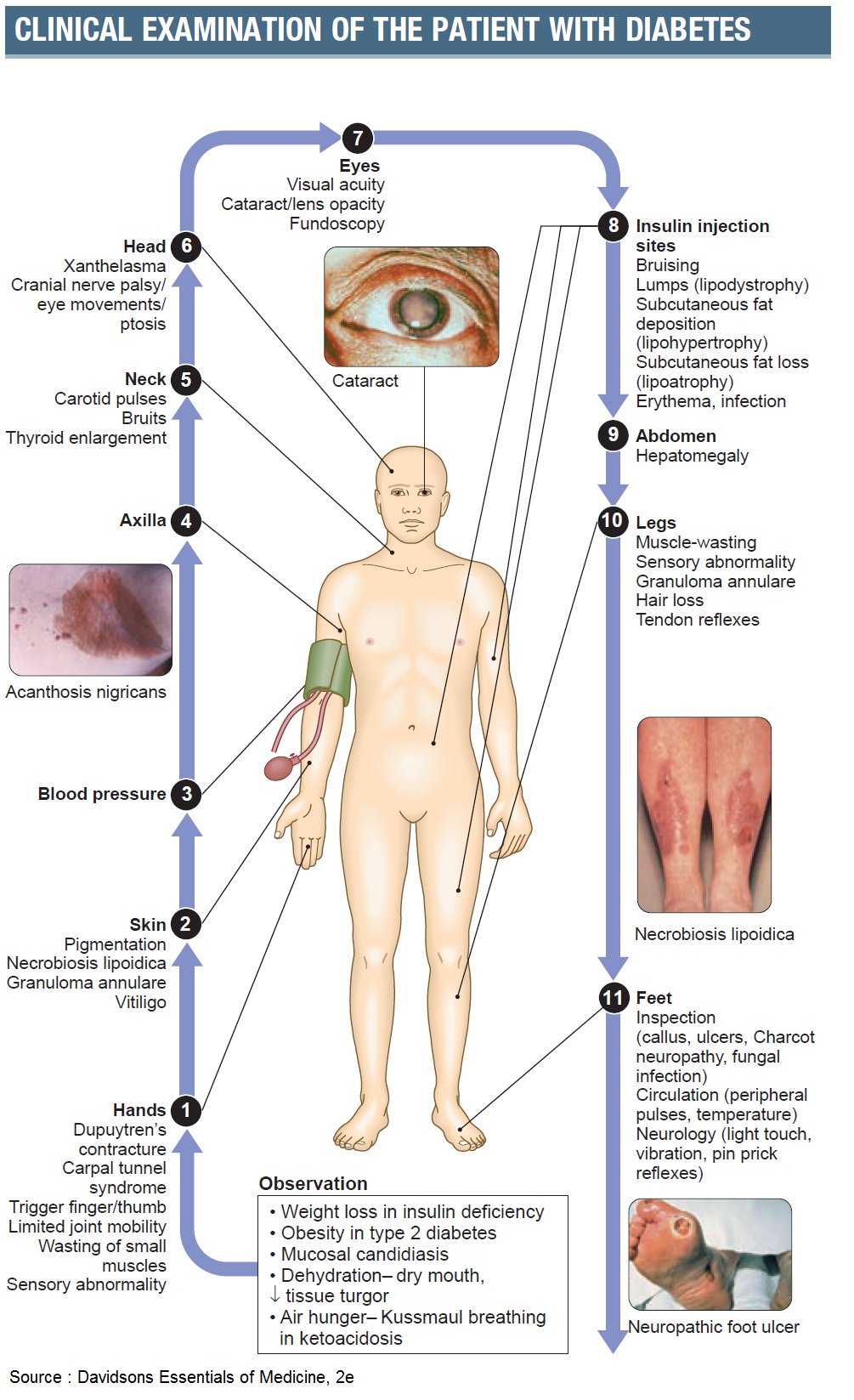 Clinical examination for Diabetes - Treatment @ MDIMC