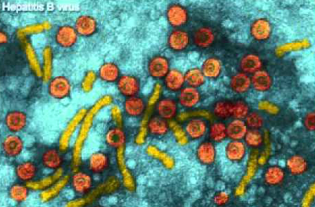 Hepatitis B Virus