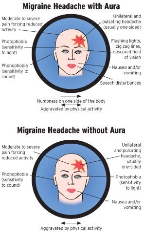 Migraine, Headache, Aura - Treatment @ MDIMC