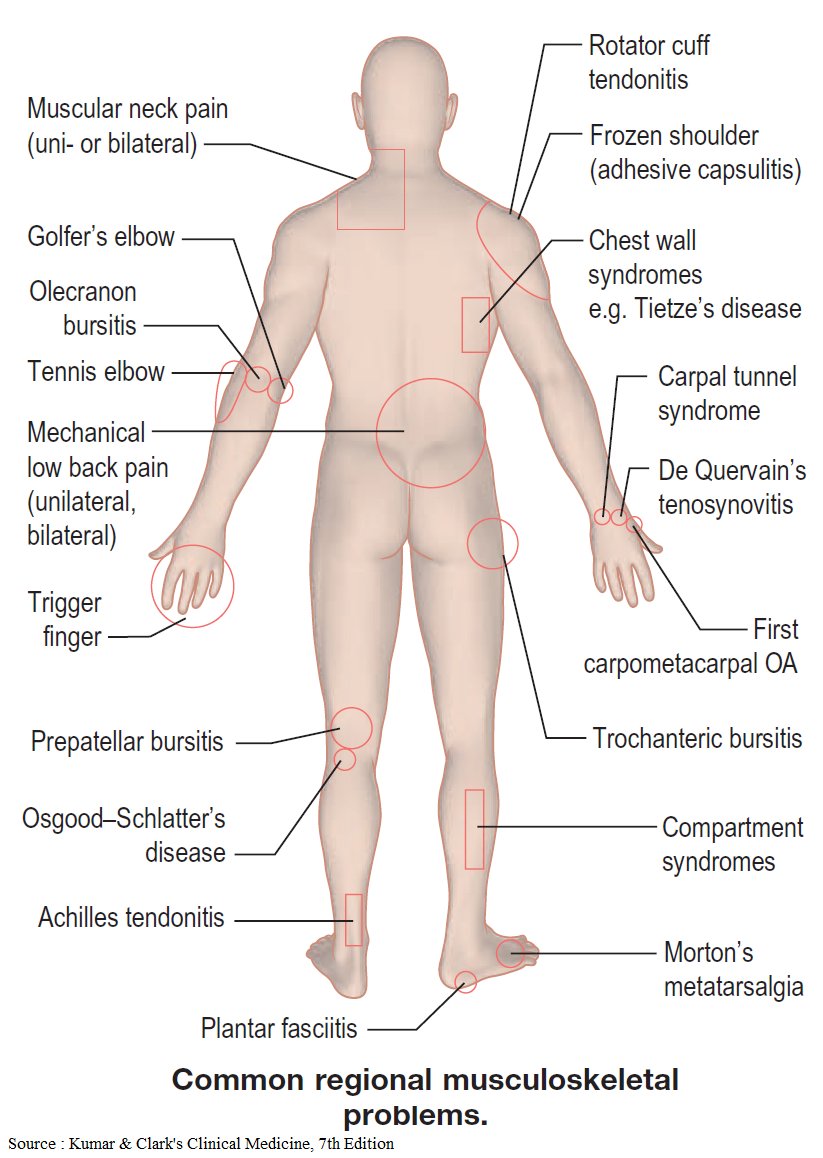 Musculoskeletal problems - Chiropractic pain management at AMDA SG Tel: 6694 1661