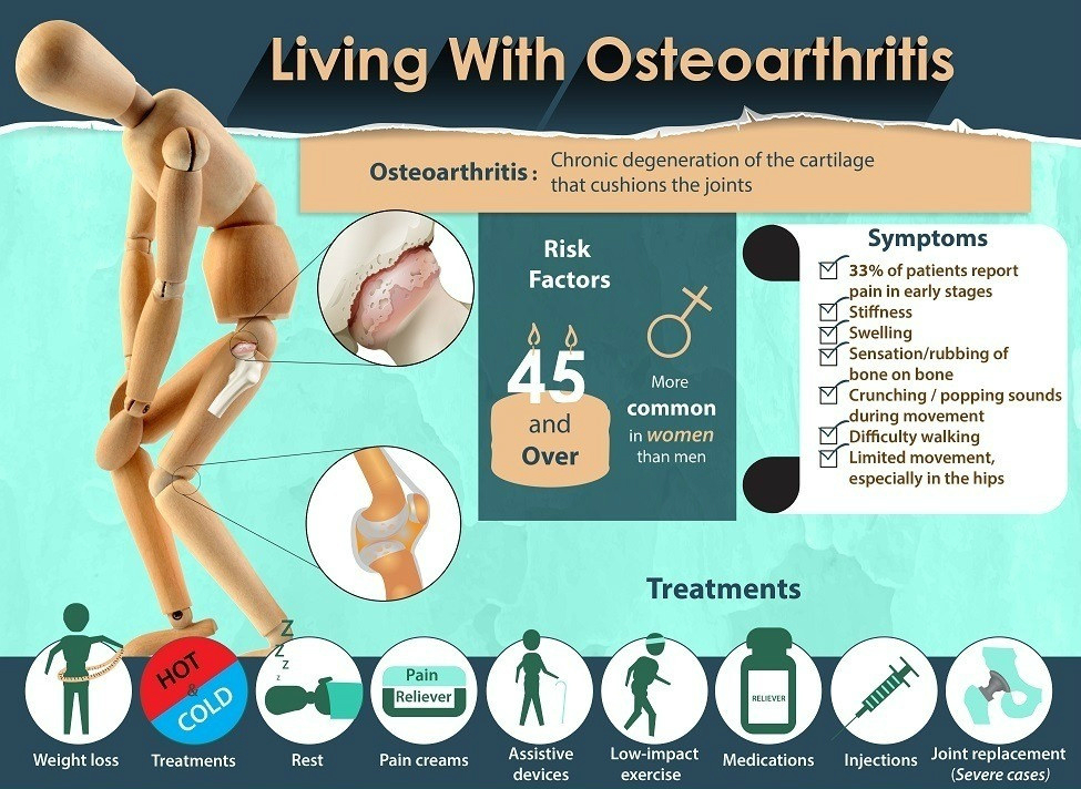 A nyaki gerinc tüneteinek gerinctelen osteoarthritisének kezelése