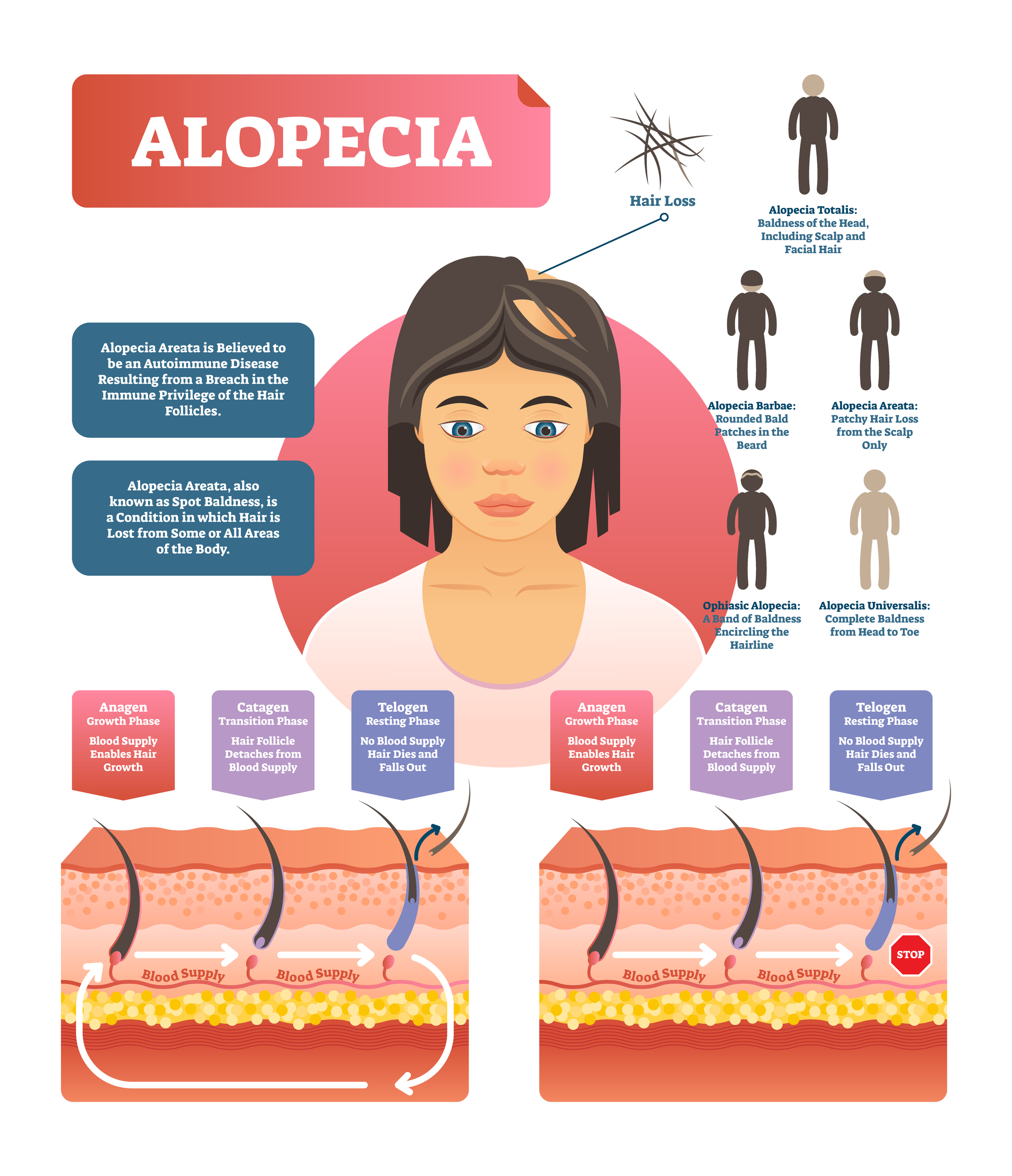 Alopecia Treatment @ MDIMC