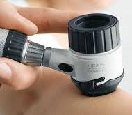 DOCTOR'S ADVICE - DERMASCOPE & DERMOSCOPY - SKIN CANCER