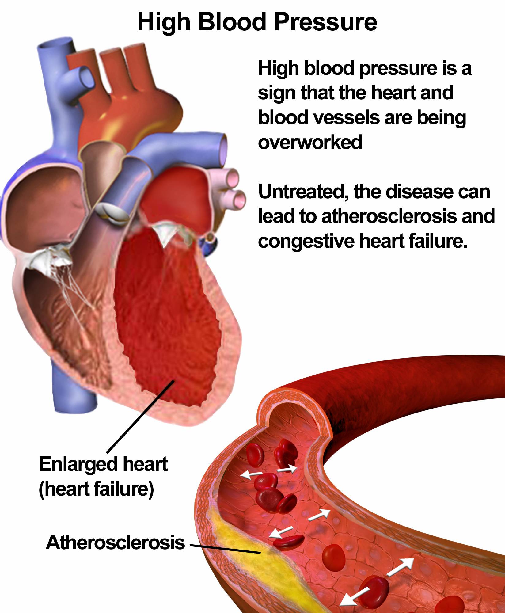 Blood Pressure Reading Chart Singapore