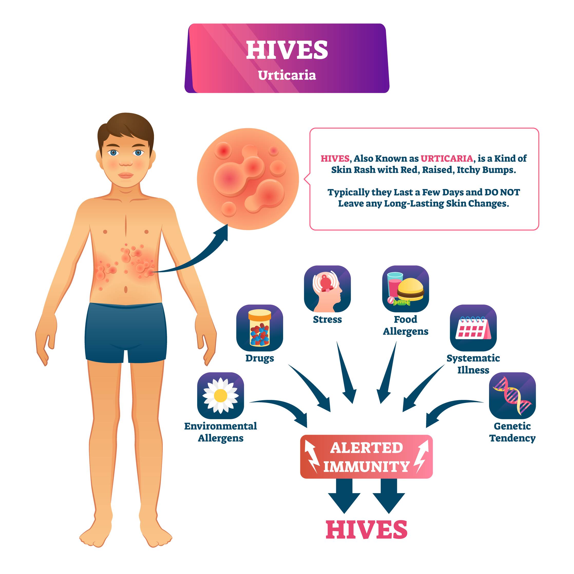 Skin Conditions That Mimic Chronic Hives