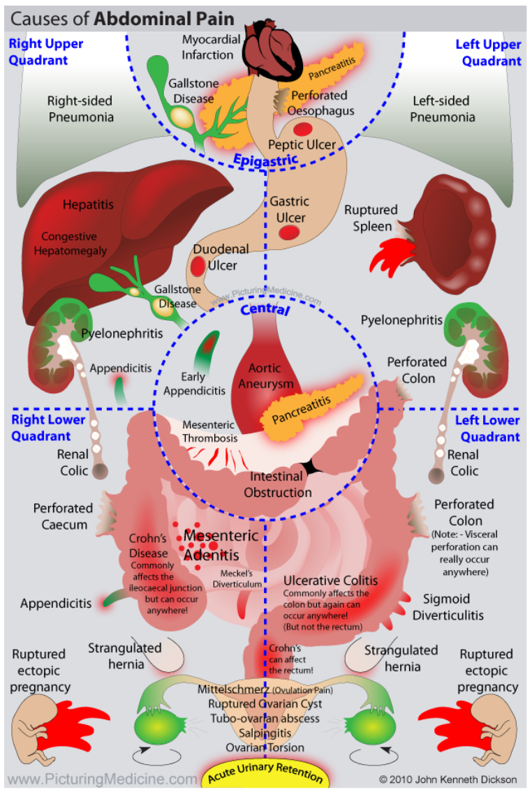 Abdominal Quadrant Chart