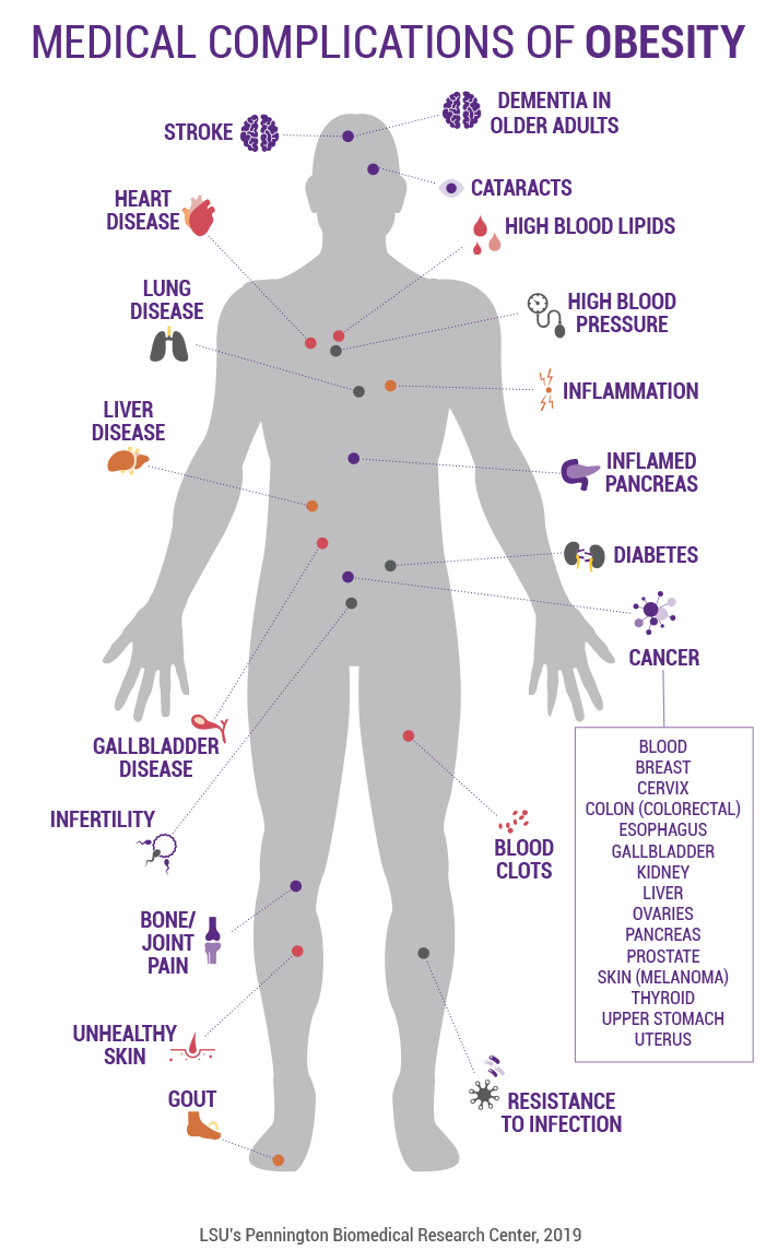 Medical complications / Obesity & Safe weight loss - Health Screening @ MDIMC